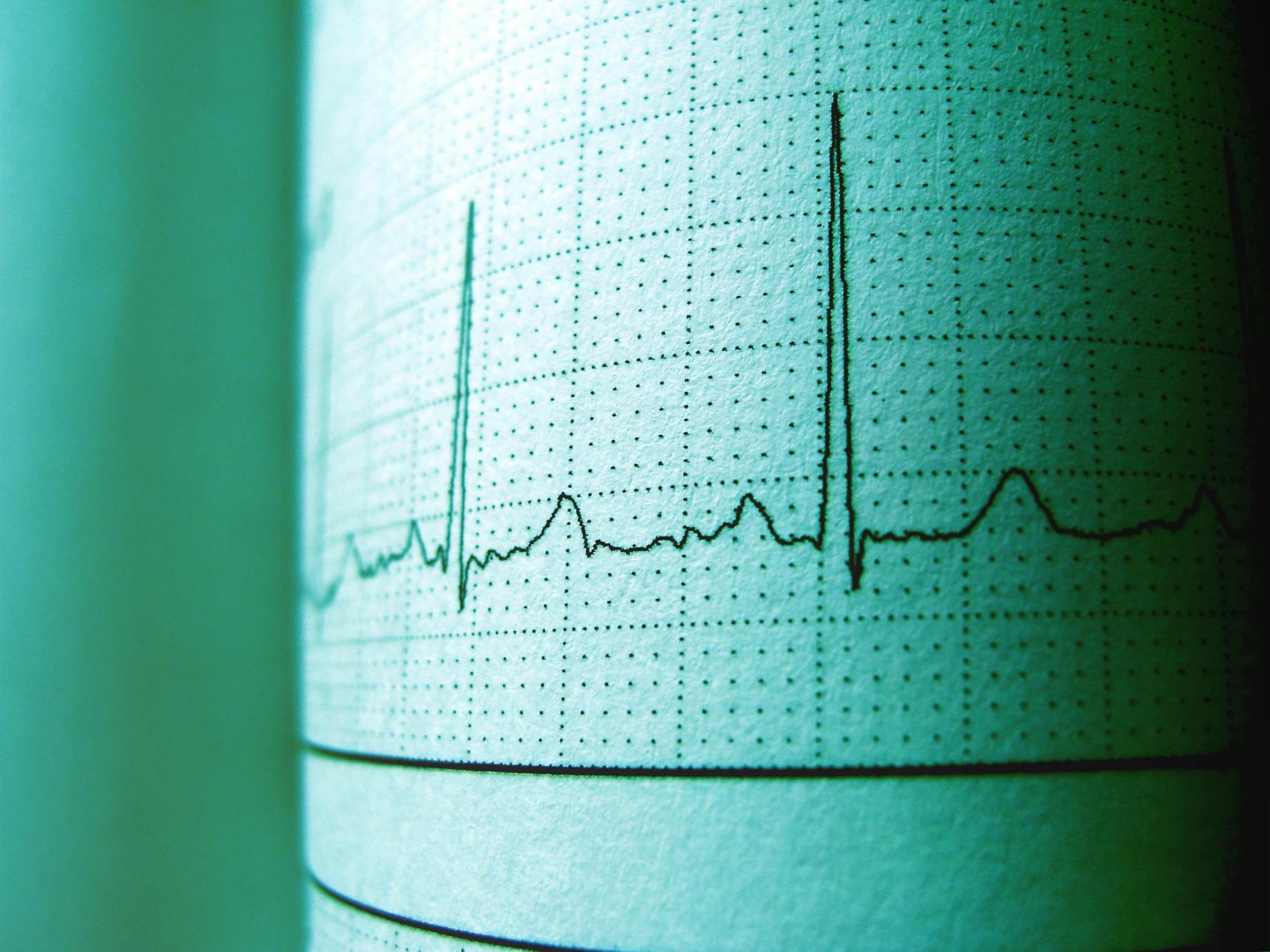 Rhythm as Key to GPT-4o's Emotional Attunement? User Explores 'Summoning Script'
